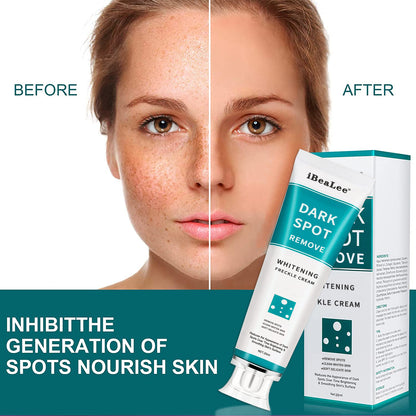 Dark Spot Removal Whitening Freckle Cream