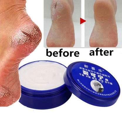 Herbal Anti Crack Foot Cream