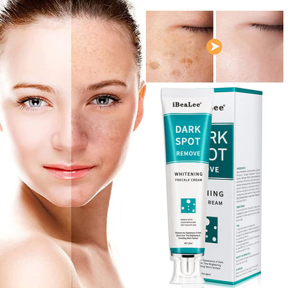 Dark Spot Removal Whitening Freckle Cream