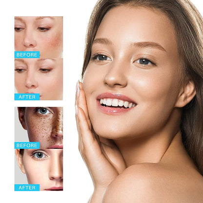 Dark Spot Removal Whitening Freckle Cream