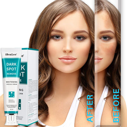 Dark Spot Removal Whitening Freckle Cream