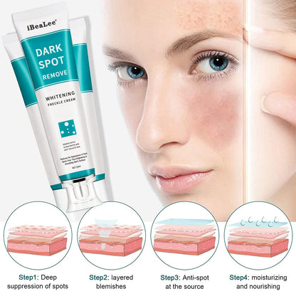 Dark Spot Removal Whitening Freckle Cream