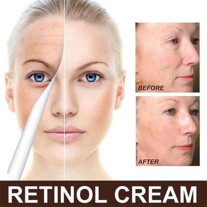 Retinol Wrinkles Removal Cream