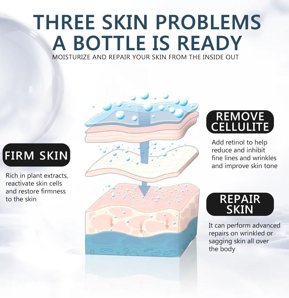 Retinol Anti Cellulite Body Cream Collagen Anti Aging Improve Sagging Skin Remove Wrinkle Firming Lifting Whiten Body Skin Care