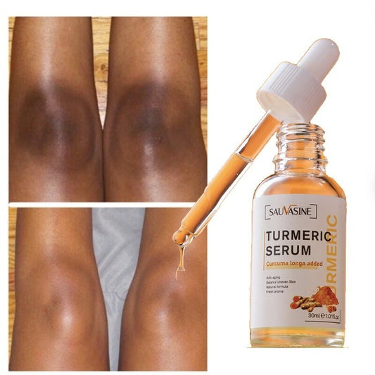 Turmeric Lemon Oil Skin Glow To Lightening Acne Dark Patches, Acne Bright Skin Dark Spot Corrector Face Whitening Serum