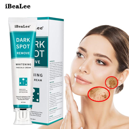 Dark Spot Removal Whitening Freckle Cream