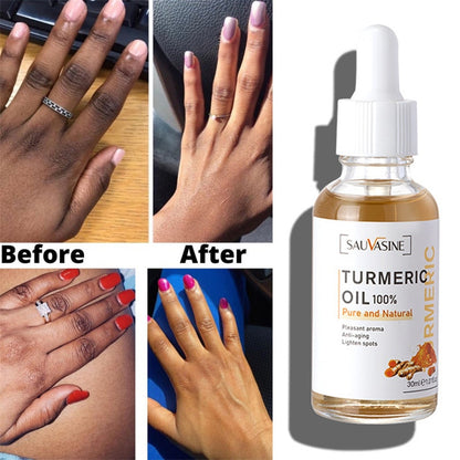 Turmeric Lemon Oil Face Whitening Serum For Skin Glow, Lightening Acne Dark Patches, Acne Bright Skin Dark Spot Corrector