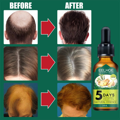 5 Days Ginger Hair Growth Essence