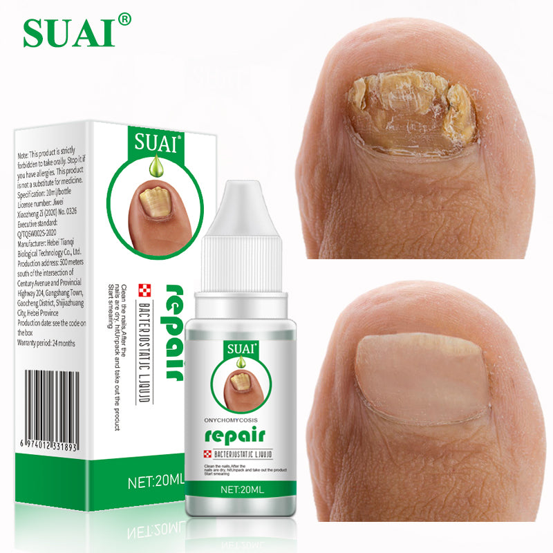 Nail Fungal Treatment Feet Care Essence