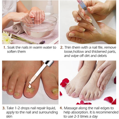 Nail Fungal Treatment Feet Care Essence