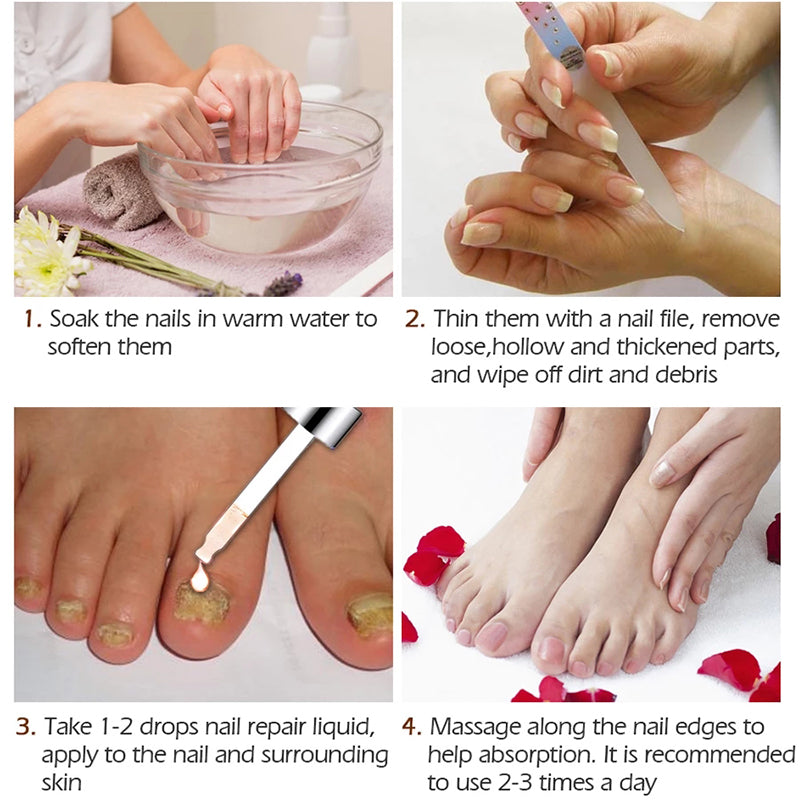 Nail Fungal Treatment Feet Care Essence